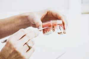 dentist showing dental implant model
