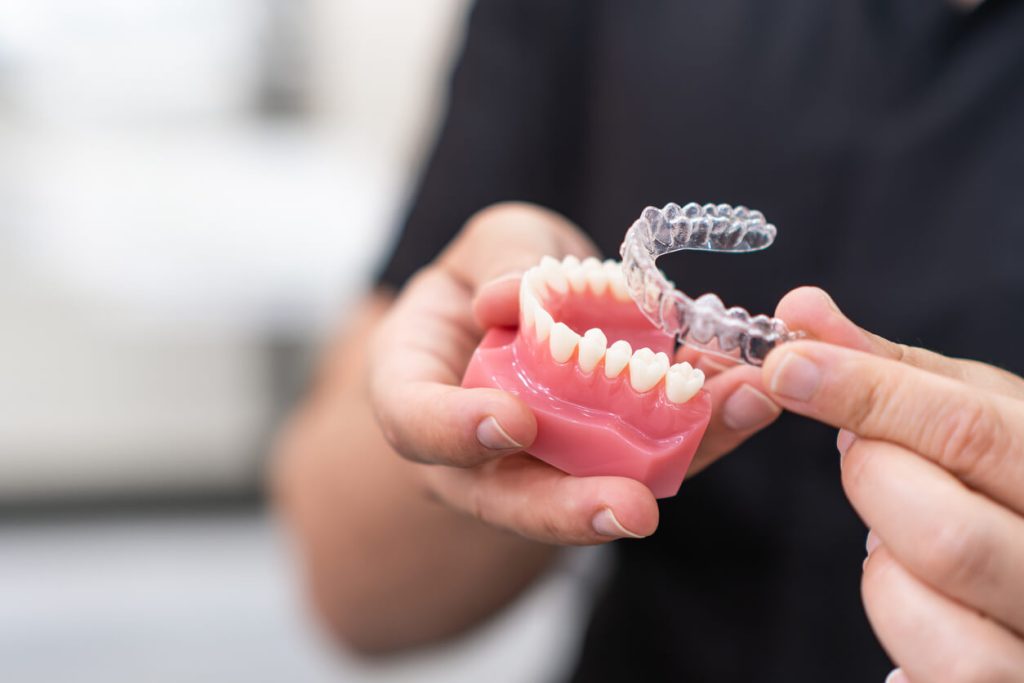 how long does invisalign take