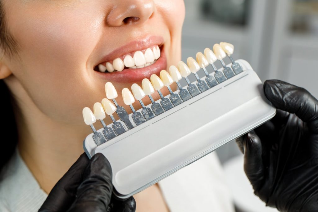 Cosmetological teeth whitening in a dental clinic