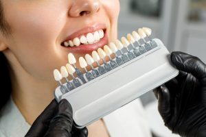 Cosmetological teeth whitening in a dental clinic