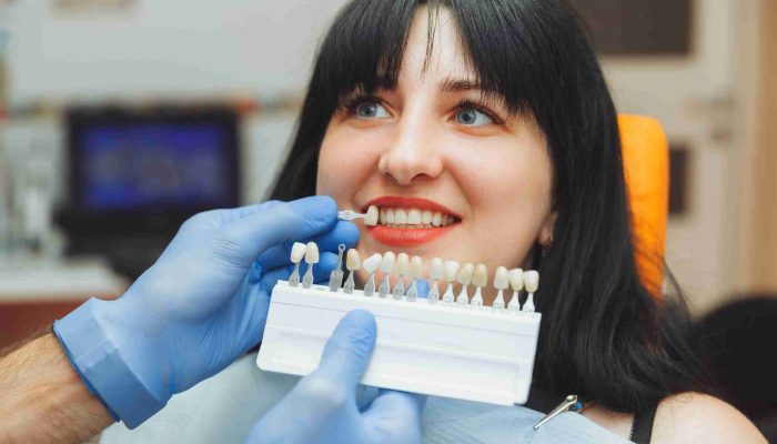 the-dentist-selects-the-color-of-the-enamel-of-the-2022-06-29-10-47-24-utc